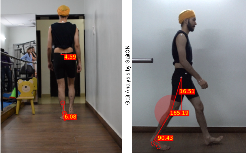 How To Do A Gait Assessment With GaitON | Posture & Gait Analysis