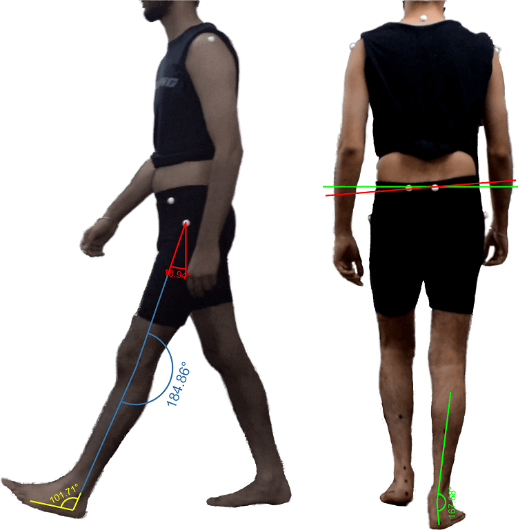 Auptimo Systems For Gait Analysis Posture Sports Motion Analysis 7040