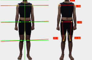 An effective posture assessment form you can use in your clinic - auptimo