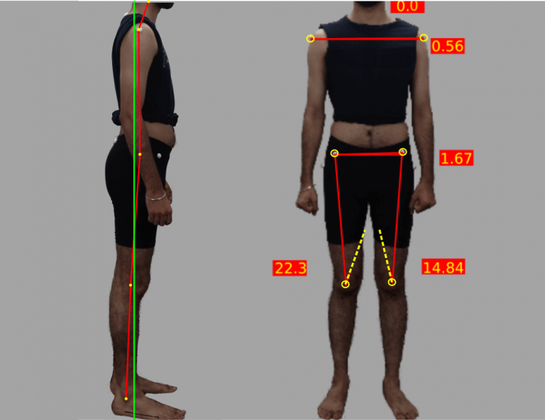 Posture Analysis | GaitON video motion analysis system by auptimo