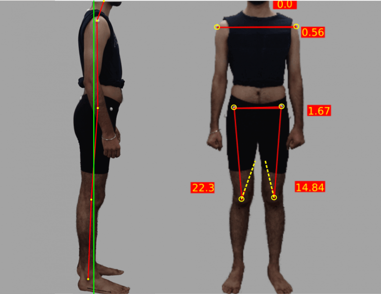 Posture_Running Assessment