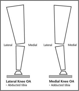 Training_Knee-Abduction_3