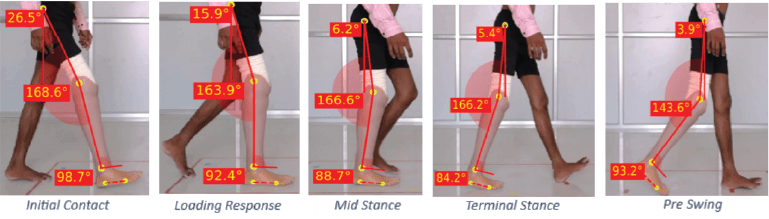 prosthetic gait cycle