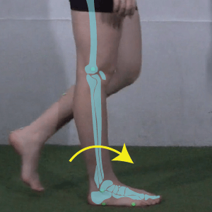 Ankle rocker: gait rocker