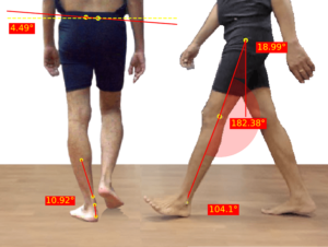 GaitON Gait Analysis System