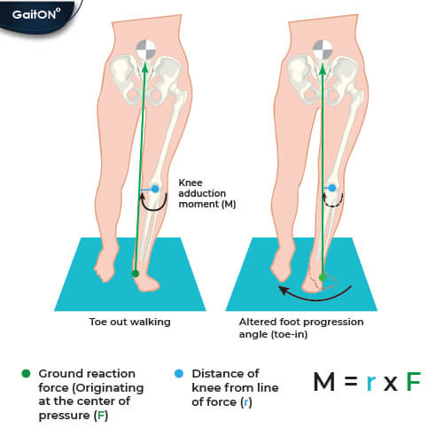 Reduced Knee adduction moment with toe in walking