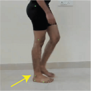 stance phase of the gait cycle