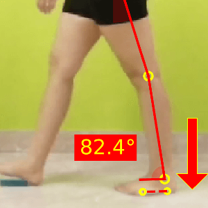 Gait analysis checlist_Delayed heel rise