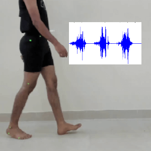 effect of EMG on gait speed