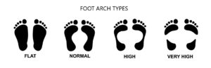 Foot Arch Types