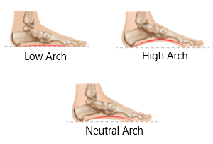 Posture_Foot arch