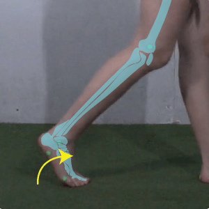 Forefoot rocker; gait rocker