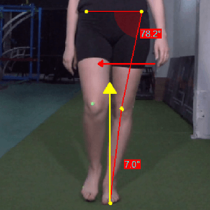 Gait retraining_Step width