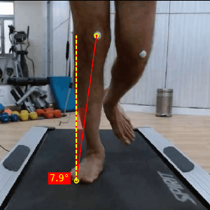 Knee valgus Running mechanics ACL injury
