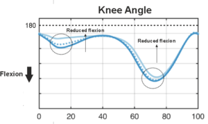 Knee_speed_variation