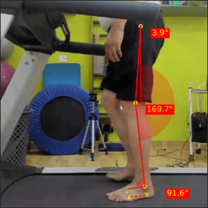Left mid stance_Parkinson's gait