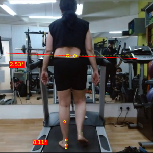 Left mid stance posterior