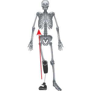 Medial thrust of Prostheses 2