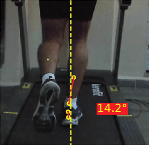 runnning biomechanics : Narrow Step Width