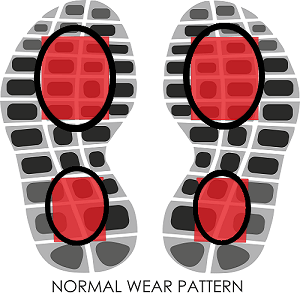 Normal Shoe wear pattern_1