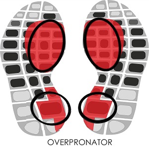 OverpronatorShoe wear pattern_1