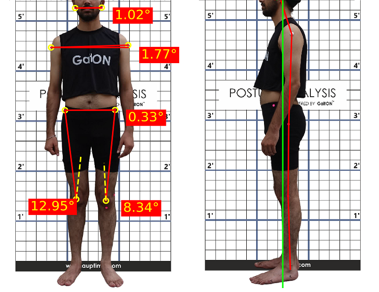 Posture Analysis Cover