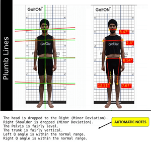 Posture-Analysis-System-data-5
