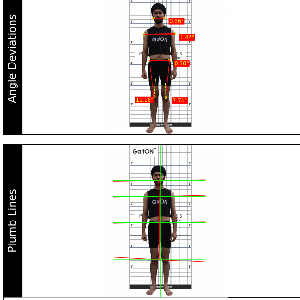 Posture Analysis System_ Plumb Lines & Postural Deviations