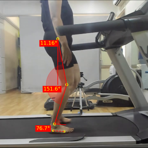 Right mid stance lateral_Quadriceps avoidance gait