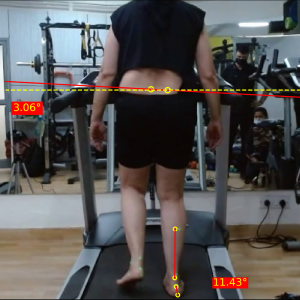 Right mid stance posterior
