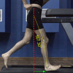 Running gait analysis software_Biomechanical faults