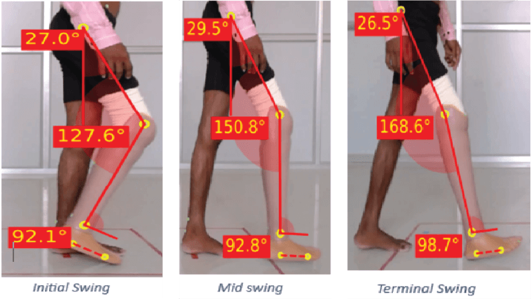 prosthetic gait cycle