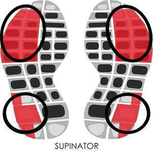 Supinator Shoe wear pattern_1