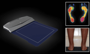 Plantar Pressure Analysis System