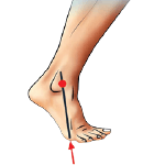 ankle is plantar fixed foot Strike pattern