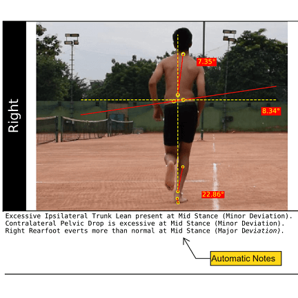 Running gait analysis software_Automatic Notes