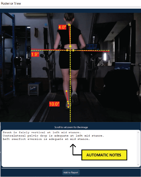 Running gait analysis software_Automatic Notes