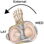 external screw home mechanism