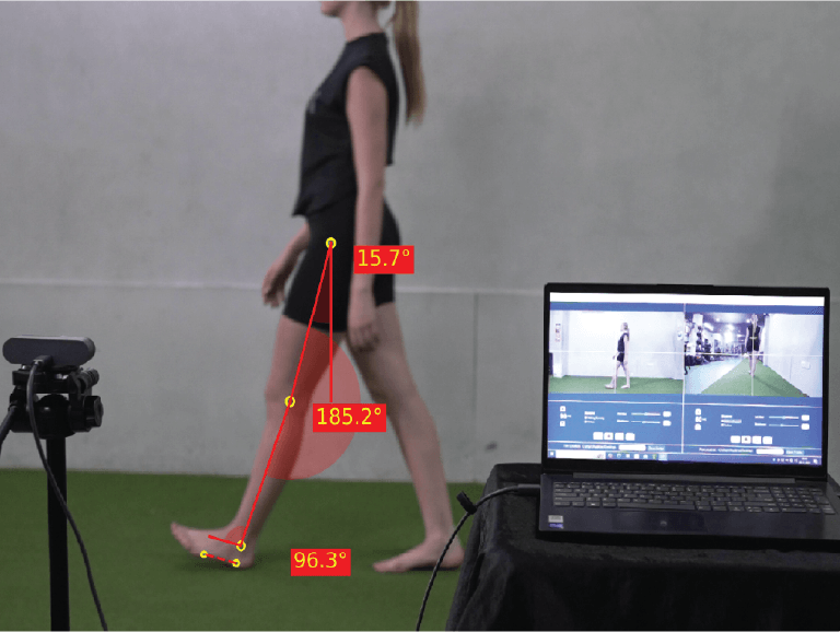 GaitON Gait Analysis System