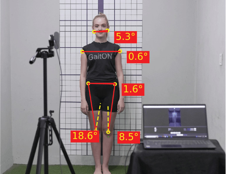 Posture Analysis Cover