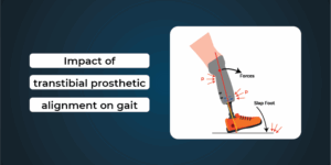 prosthetic alignment