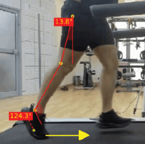 reduced hip extension