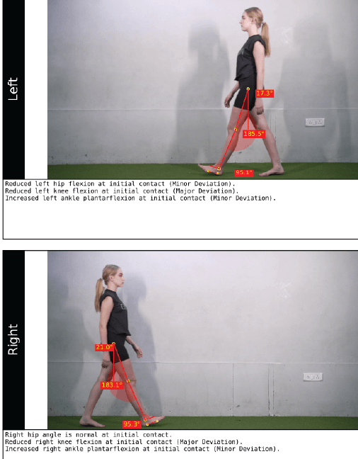 Gait Analysis System_images data