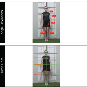 Posture Analysis System_ Plumb Lines & Postural Deviations